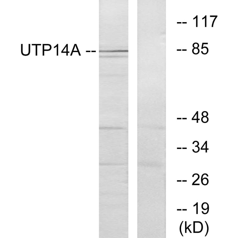 Western Blot - Anti-UTP14A Antibody (C11624) - Antibodies.com