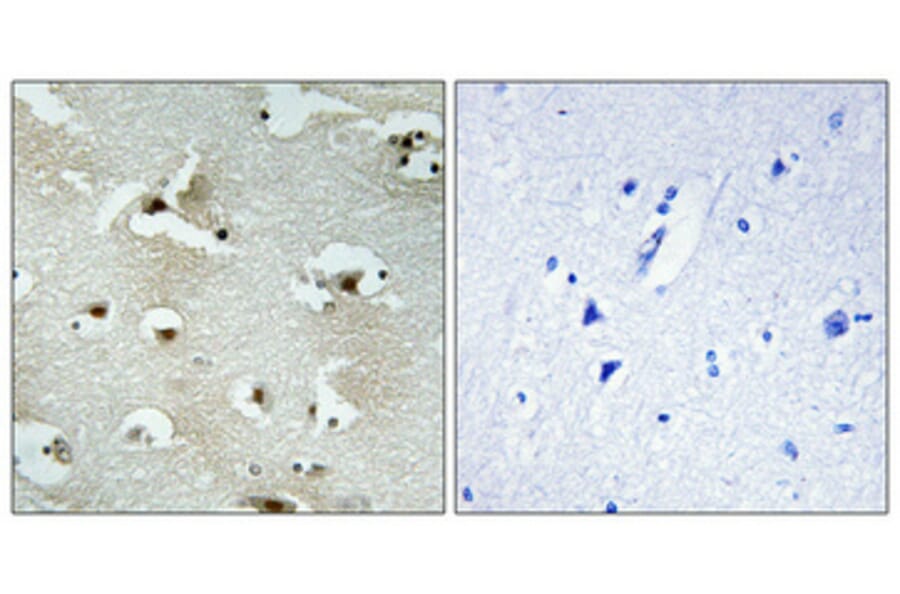 Immunohistochemistry - Anti-UTP14A Antibody (C11624) - Antibodies.com