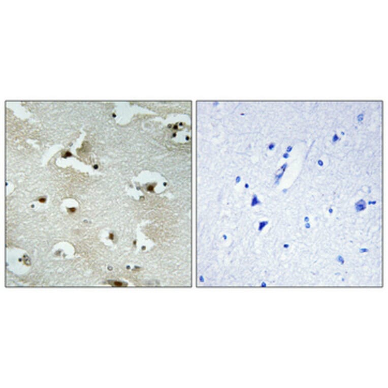 Immunohistochemistry - Anti-UTP14A Antibody (C11624) - Antibodies.com