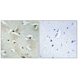 Immunohistochemistry - Anti-UTP14A Antibody (C11624) - Antibodies.com
