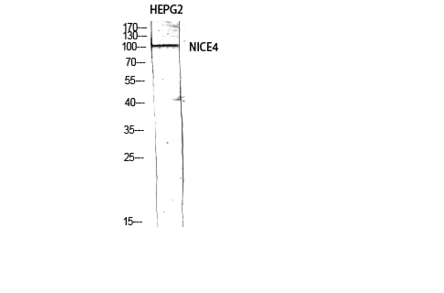 Western Blot - Anti-UBAP2L Antibody (C19423) - Antibodies.com