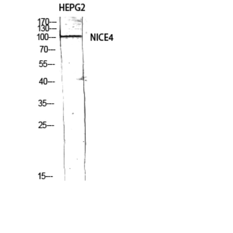 Western Blot - Anti-UBAP2L Antibody (C19423) - Antibodies.com