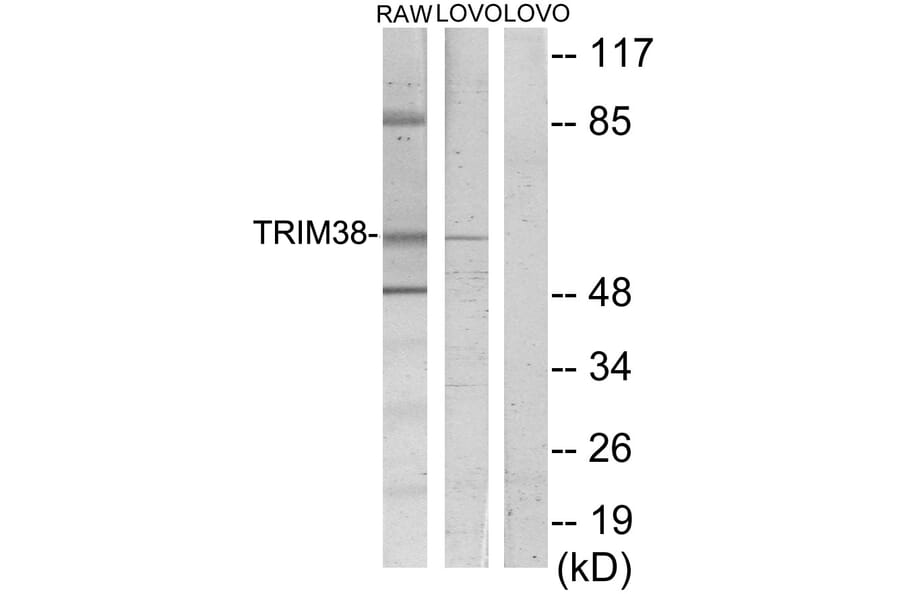 Western Blot - Anti-TRIM38 Antibody (C10031) - Antibodies.com