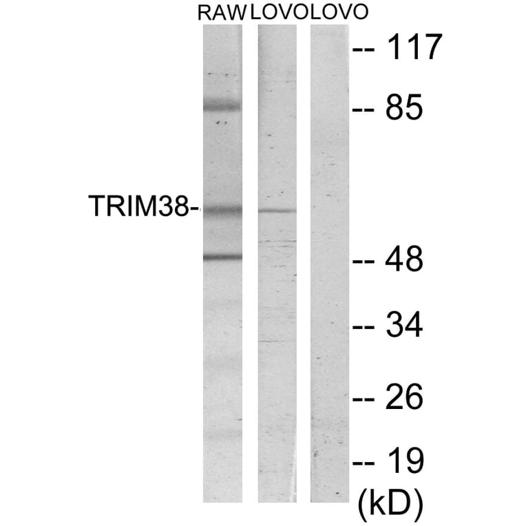 Western Blot - Anti-TRIM38 Antibody (C10031) - Antibodies.com