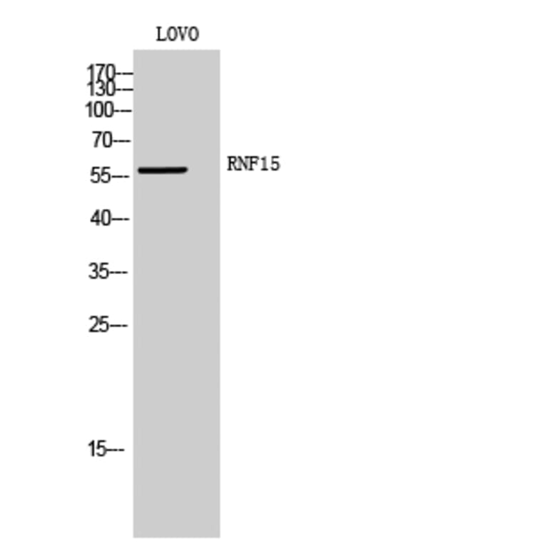 Western Blot - Anti-TRIM38 Antibody (C10031) - Antibodies.com