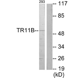 Western Blot - Anti-TR11B Antibody (C10019) - Antibodies.com