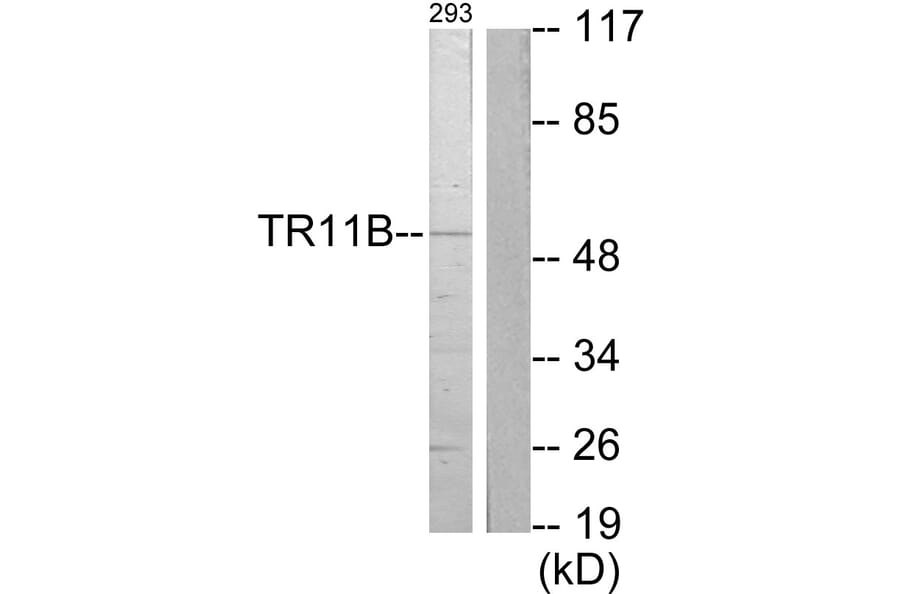Western Blot - Anti-TR11B Antibody (C10019) - Antibodies.com