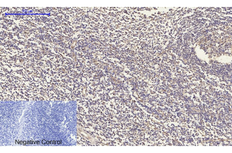 Immunohistochemistry - Anti-TR11B Antibody (C10019) - Antibodies.com