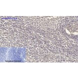 Immunohistochemistry - Anti-TR11B Antibody (C10019) - Antibodies.com