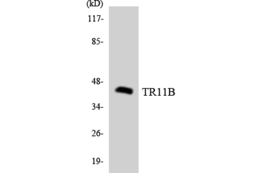 Western Blot - Anti-TR11B Antibody (R12-3646) - Antibodies.com