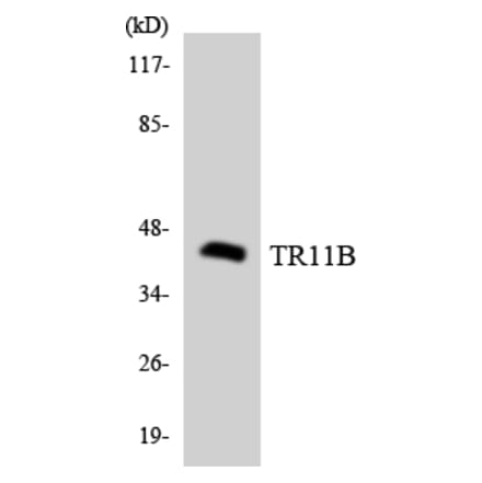 Western Blot - Anti-TR11B Antibody (R12-3646) - Antibodies.com