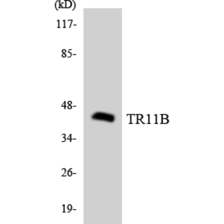 Western Blot - Anti-TR11B Antibody (R12-3646) - Antibodies.com
