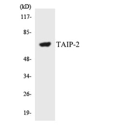 Western Blot - Anti-TAIP-2 Antibody (R12-3585) - Antibodies.com