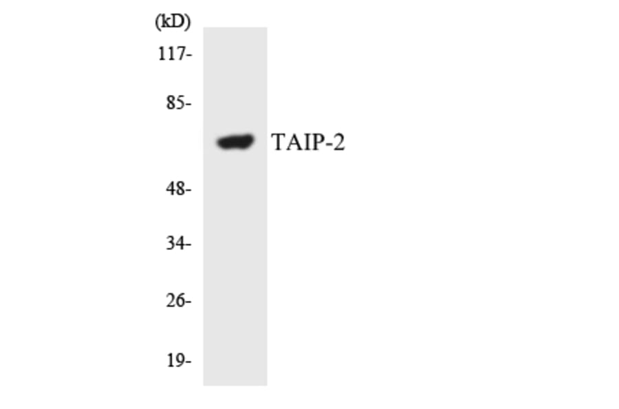 Western Blot - Anti-TAIP-2 Antibody (R12-3585) - Antibodies.com