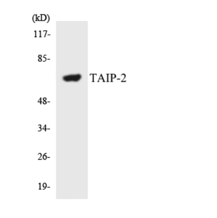 Western Blot - Anti-TAIP-2 Antibody (R12-3585) - Antibodies.com
