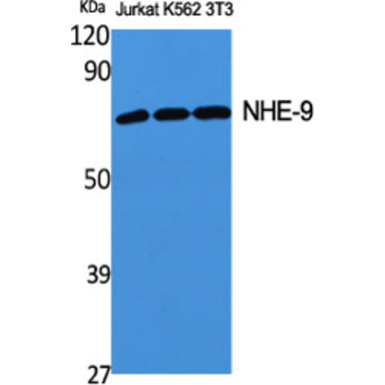 Western Blot - Anti-SLC9A9 Antibody (C18841) - Antibodies.com