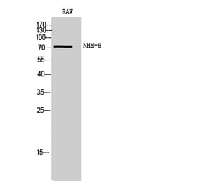 Western Blot - Anti-SLC9A6 Antibody (C18838) - Antibodies.com
