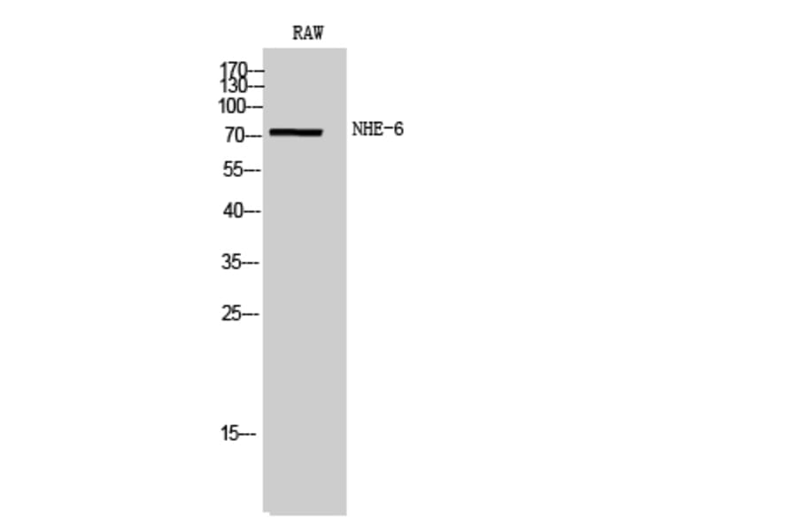 Western Blot - Anti-SLC9A6 Antibody (C18838) - Antibodies.com