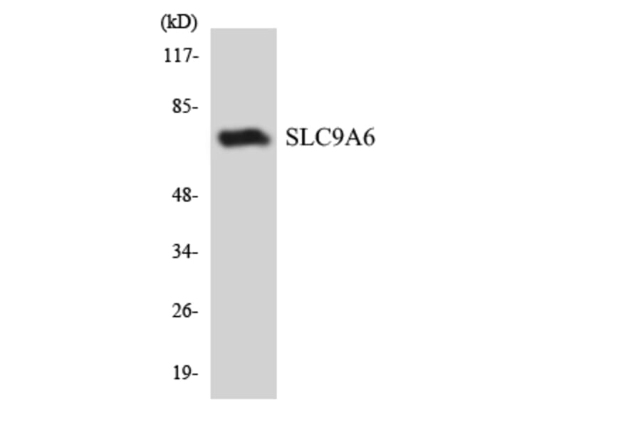 Western Blot - Anti-SLC9A6 Antibody (R12-3539) - Antibodies.com