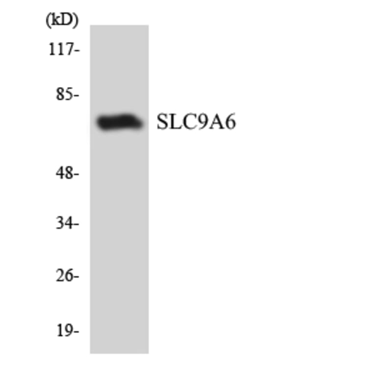 Western Blot - Anti-SLC9A6 Antibody (R12-3539) - Antibodies.com