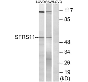 Western Blot - Anti-SFRS11 Antibody (C18926) - Antibodies.com