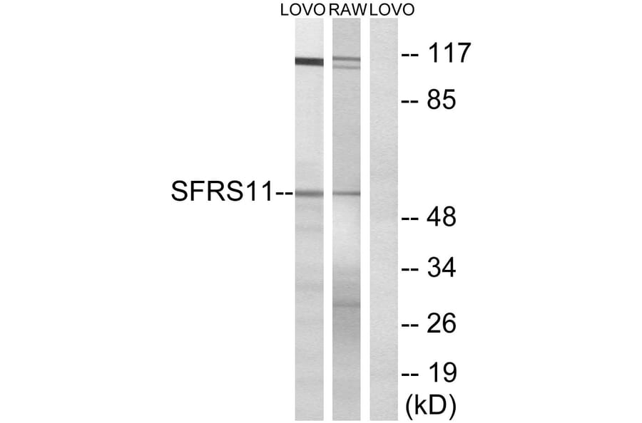 Western Blot - Anti-SFRS11 Antibody (C18926) - Antibodies.com
