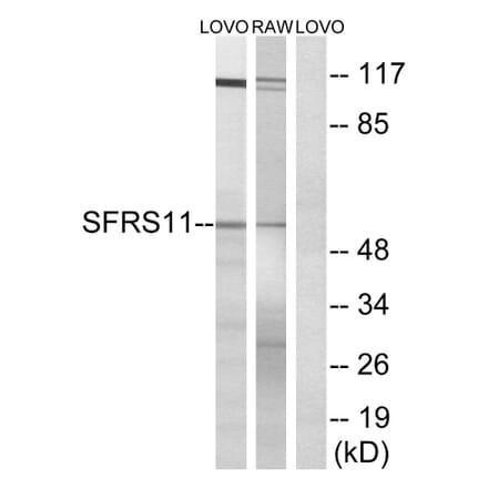 Western Blot - Anti-SFRS11 Antibody (C18926) - Antibodies.com