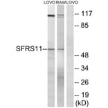 Western Blot - Anti-SFRS11 Antibody (C18926) - Antibodies.com