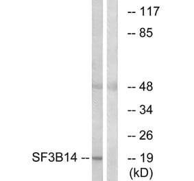 Western Blot - Anti-SF3B14 Antibody (C17844) - Antibodies.com