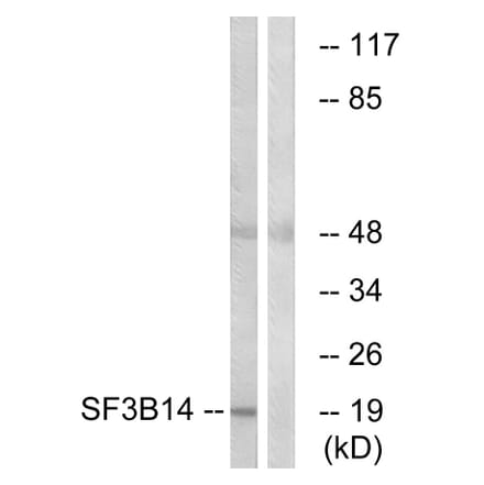 Western Blot - Anti-SF3B14 Antibody (C17844) - Antibodies.com