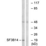 Western Blot - Anti-SF3B14 Antibody (C17844) - Antibodies.com