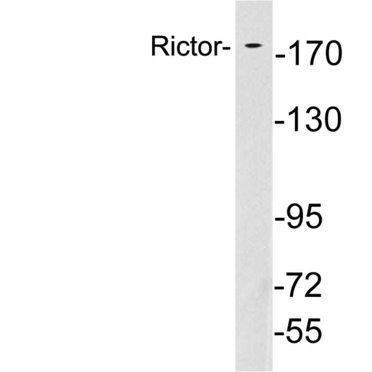 Western Blot - Anti-Rictor Antibody (R12-2333) - Antibodies.com