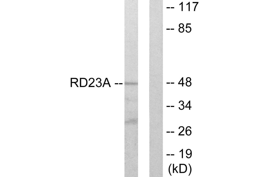 Western Blot - Anti-RAD23A Antibody (C13113) - Antibodies.com