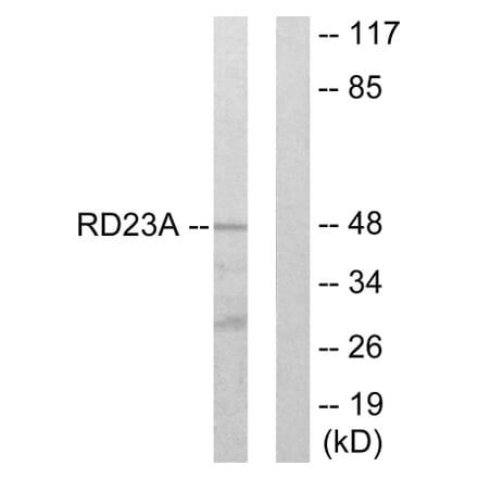 Western Blot - Anti-RAD23A Antibody (C13113) - Antibodies.com