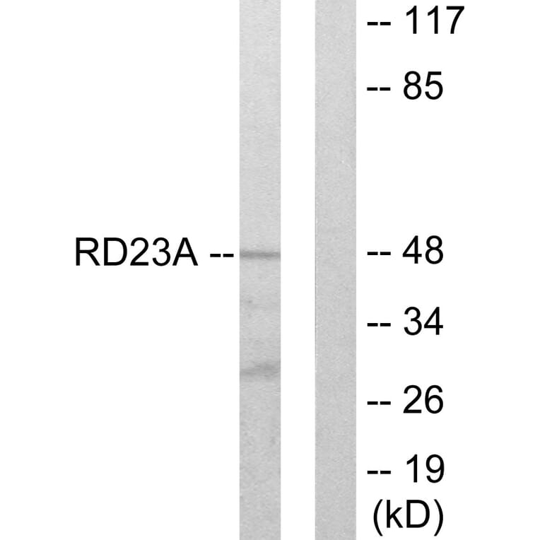 Western Blot - Anti-RAD23A Antibody (C13113) - Antibodies.com