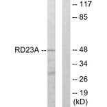 Western Blot - Anti-RAD23A Antibody (C13113) - Antibodies.com