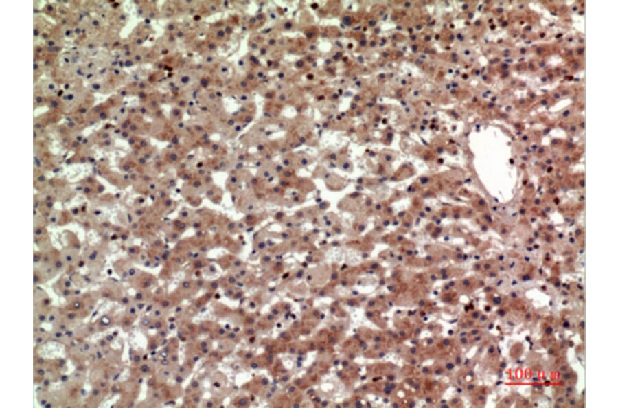 Immunohistochemistry - Anti-PTGDR2 Antibody (C30537) - Antibodies.com