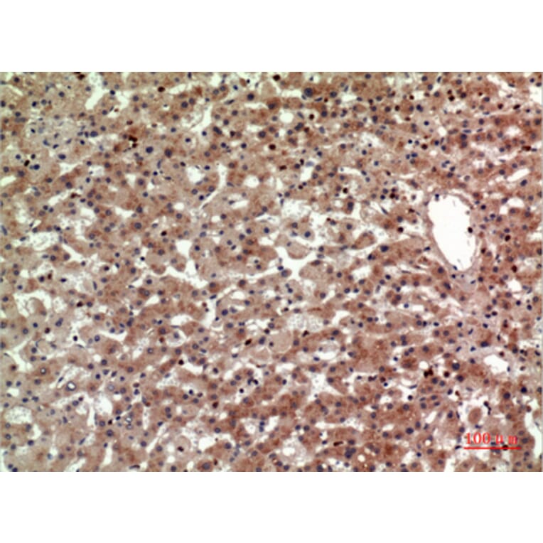 Immunohistochemistry - Anti-PTGDR2 Antibody (C30537) - Antibodies.com