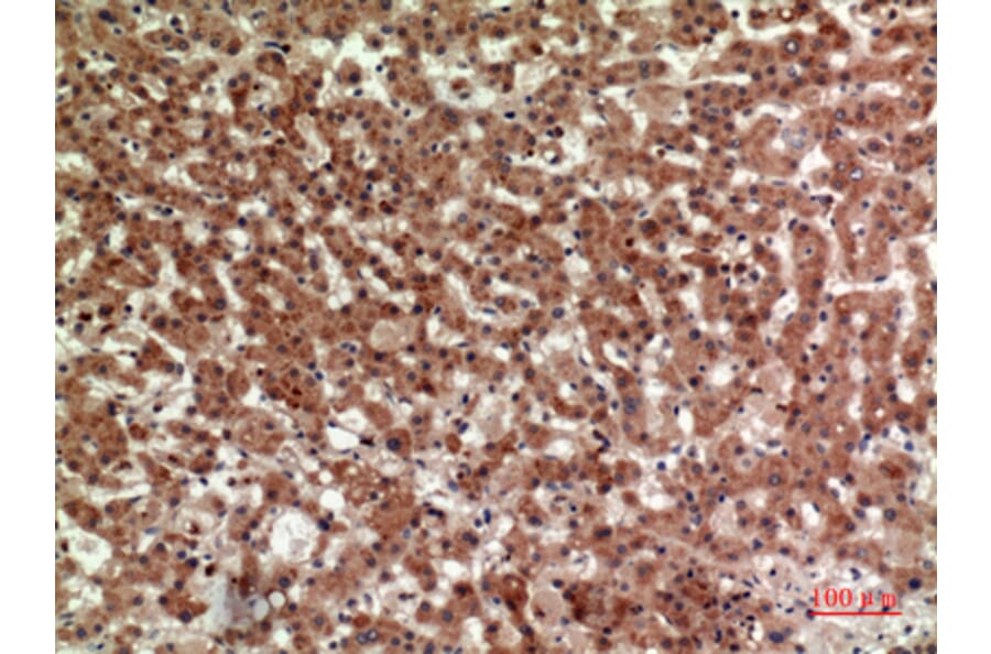 Immunohistochemistry - Anti-PTGDR2 Antibody (C30537) - Antibodies.com