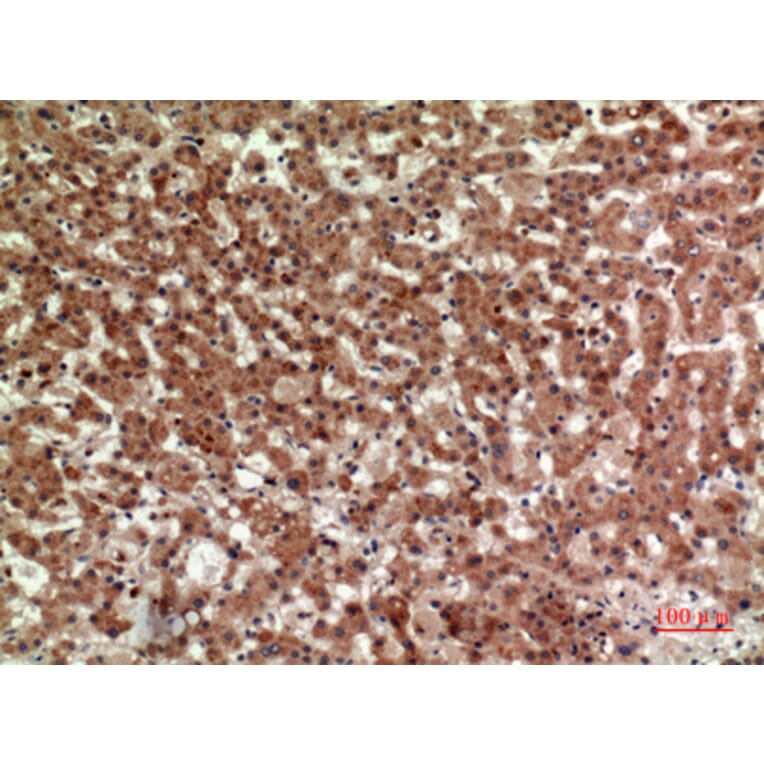 Immunohistochemistry - Anti-PTGDR2 Antibody (C30537) - Antibodies.com