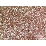 Immunohistochemistry - Anti-PTGDR2 Antibody (C30537) - Antibodies.com
