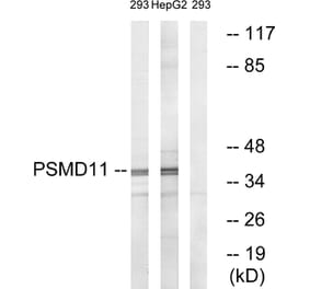 Western Blot - Anti-PSMD11 Antibody (C14020) - Antibodies.com
