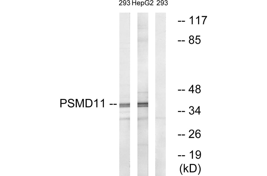 Western Blot - Anti-PSMD11 Antibody (C14020) - Antibodies.com