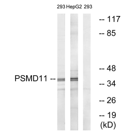 Western Blot - Anti-PSMD11 Antibody (C14020) - Antibodies.com