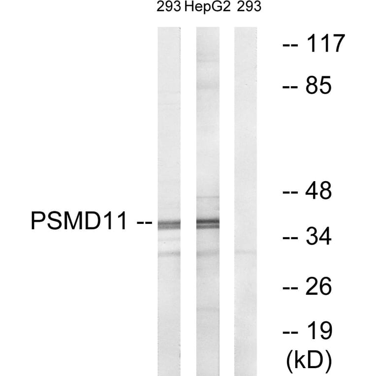 Western Blot - Anti-PSMD11 Antibody (C14020) - Antibodies.com