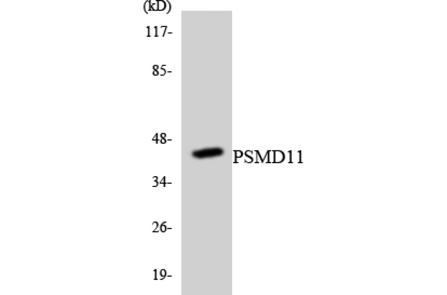Western Blot - Anti-PSMD11 Antibody (R12-3378) - Antibodies.com