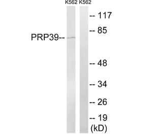 Western Blot - Anti-PRPF39 Antibody (C17848) - Antibodies.com