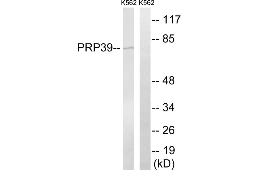 Western Blot - Anti-PRPF39 Antibody (C17848) - Antibodies.com