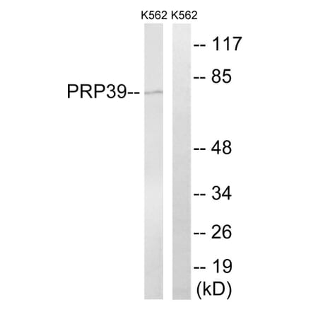 Western Blot - Anti-PRPF39 Antibody (C17848) - Antibodies.com