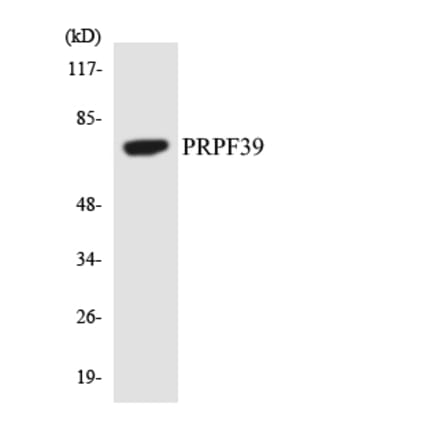 Western Blot - Anti-PRPF39 Antibody (R12-3373) - Antibodies.com